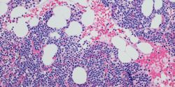 Mylenoma
