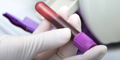 blood tests