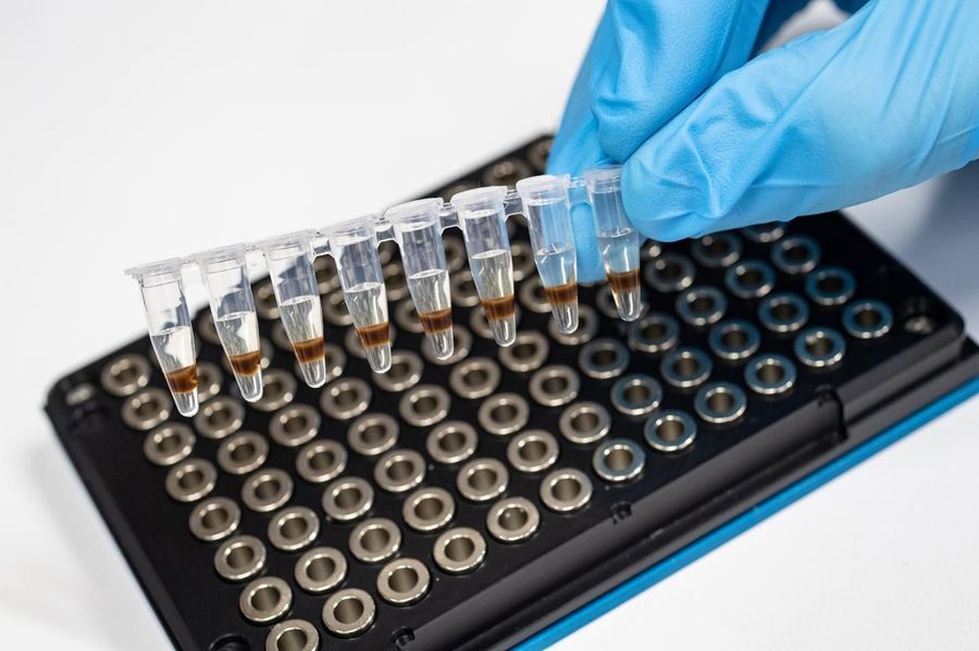 Changes in Blood Metabolite Profile Are Visible Years before Diagnosis