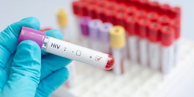 Blood sample thats tested positive for HIV