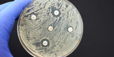 Antibiotic Sensitivity Test to show multidrug resistance in a Petri plate.